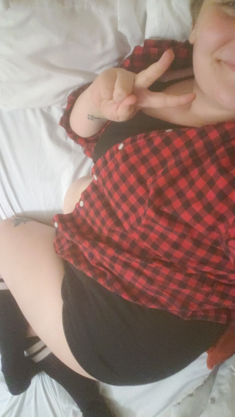 Abby Normal cover image