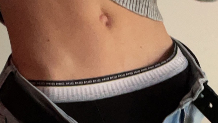 Axel π€ banner image