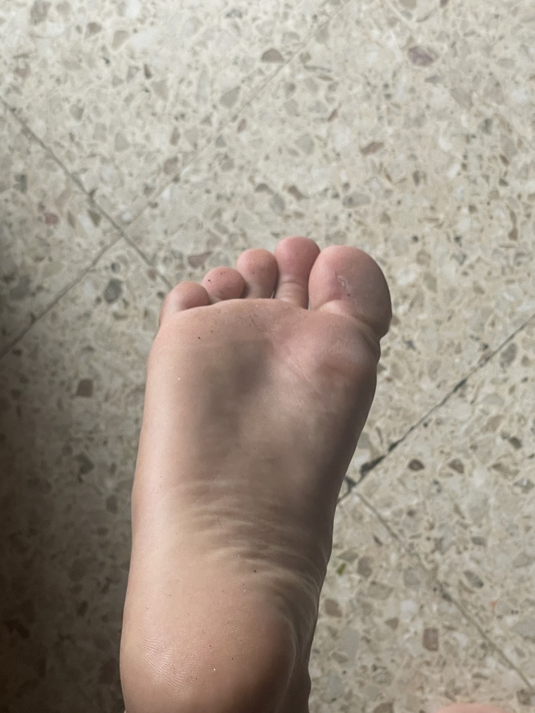 Ale 🦶🏼 cover image