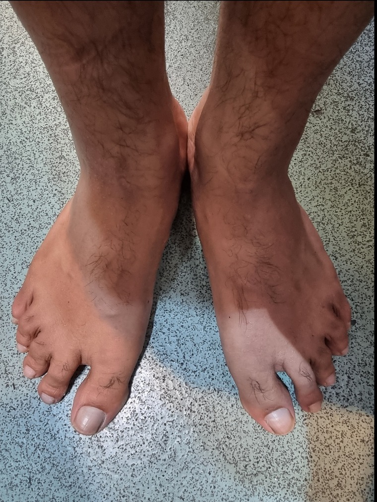 All Indian Feet banner image