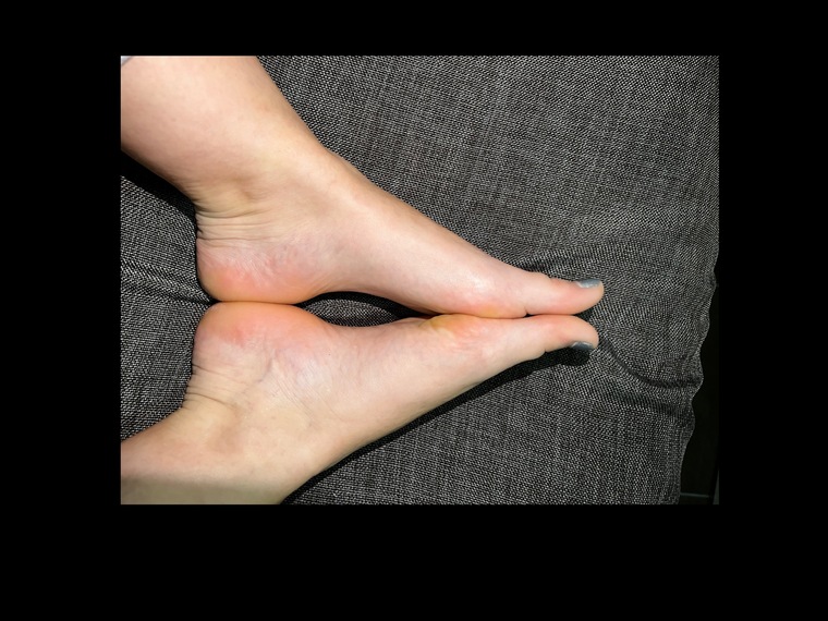 Barefoot Beanies cover image