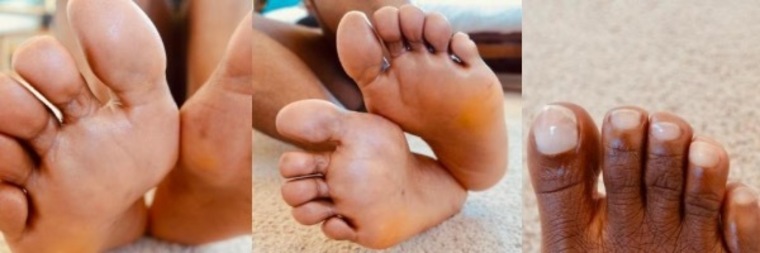 BBtoesandfeet banner image