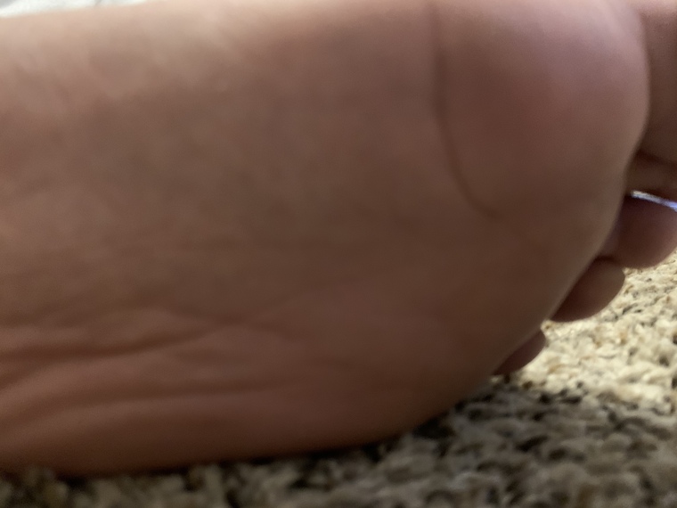 Big flat feet banner image