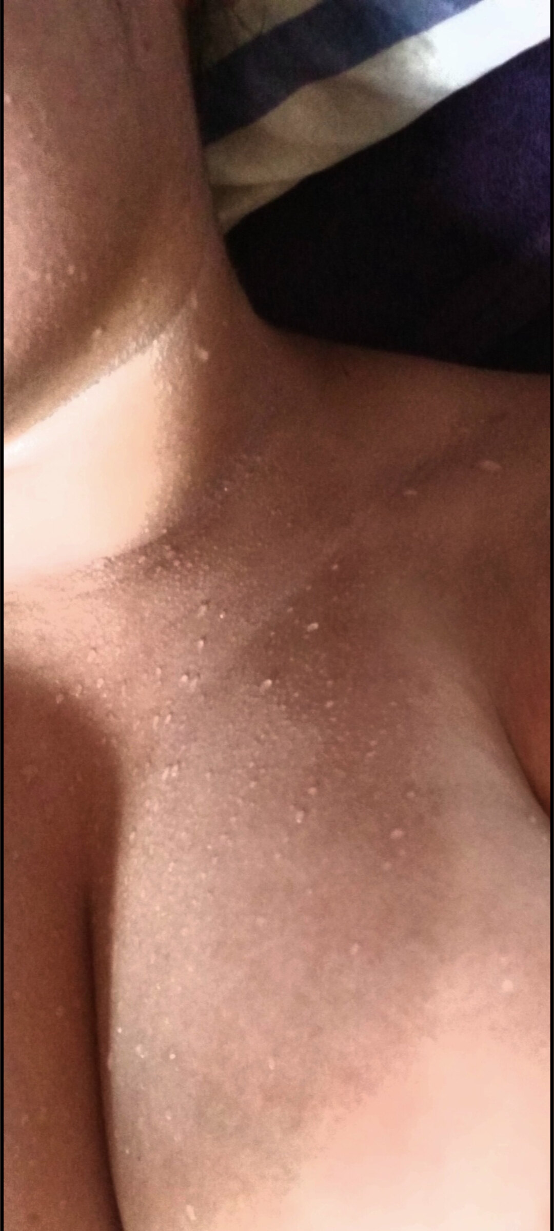Biggs Boobs Brazilian (BBB) banner image