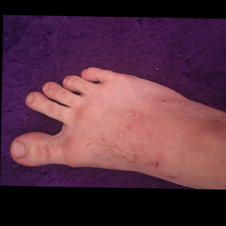Big Manly Feet cover image