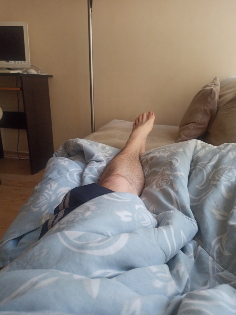 Bonydfeet cover image