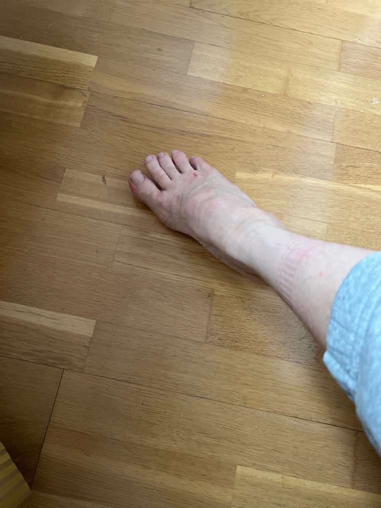 BroadwayFeet cover image