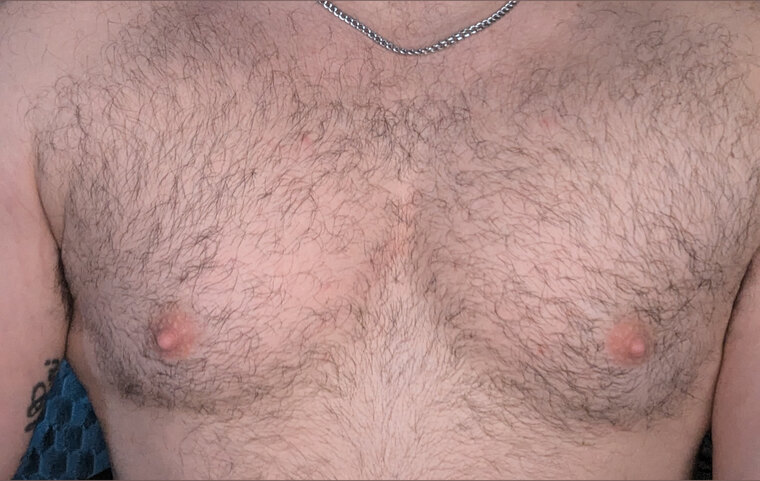 Buckshot banner image
