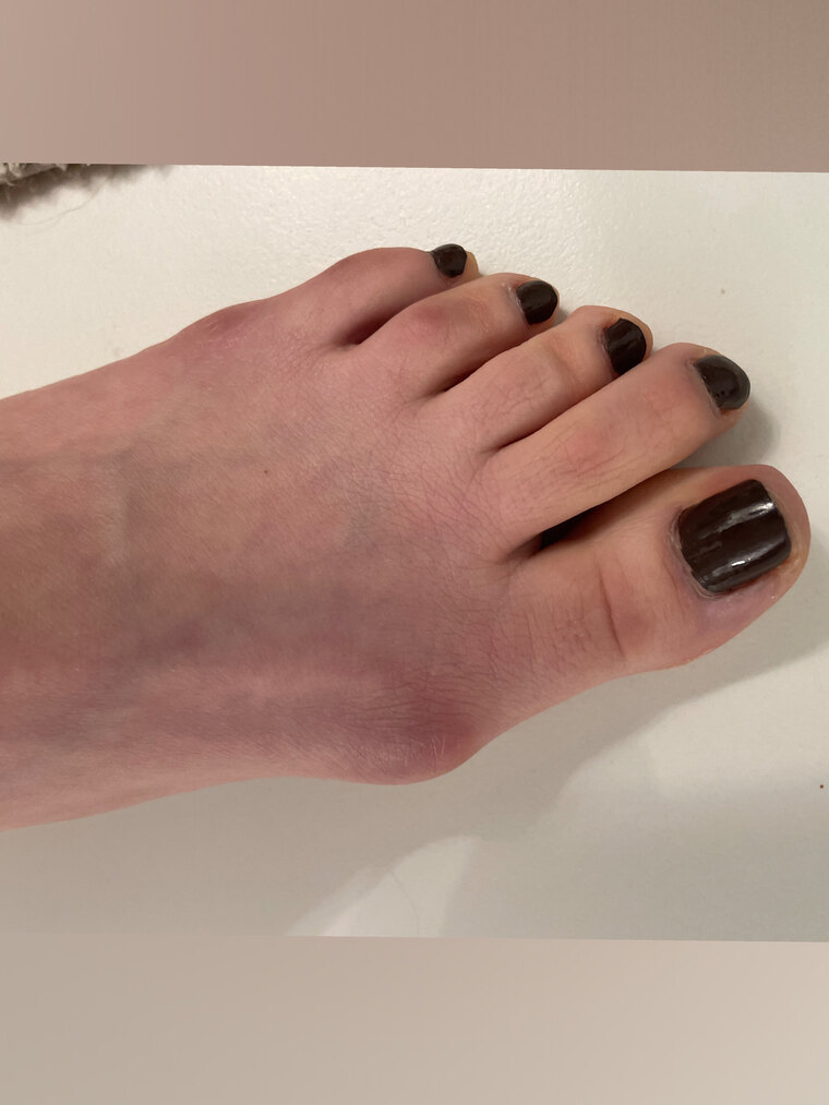 Bunion Girly banner image
