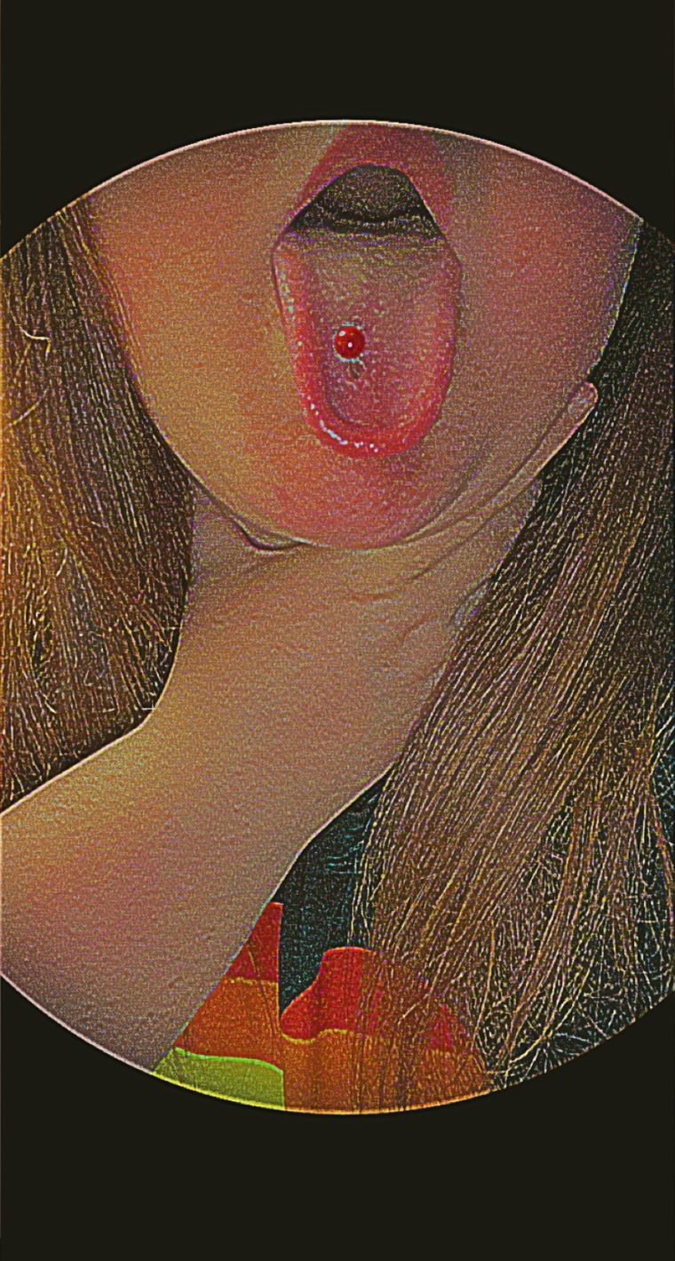 Chelley cover image