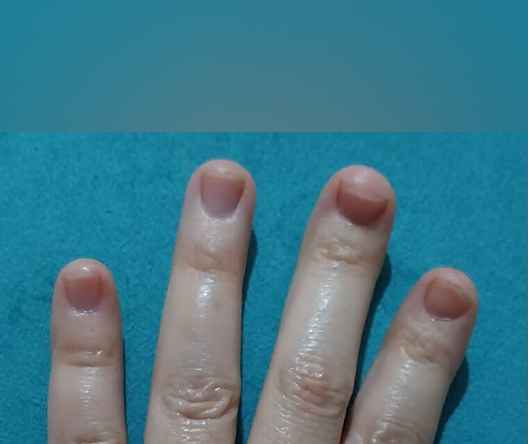 Curly Fingers banner image