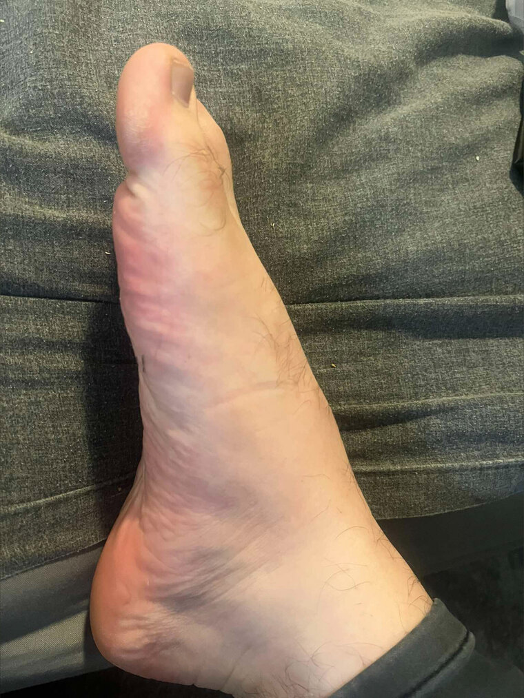 My Daily foot picture cover image