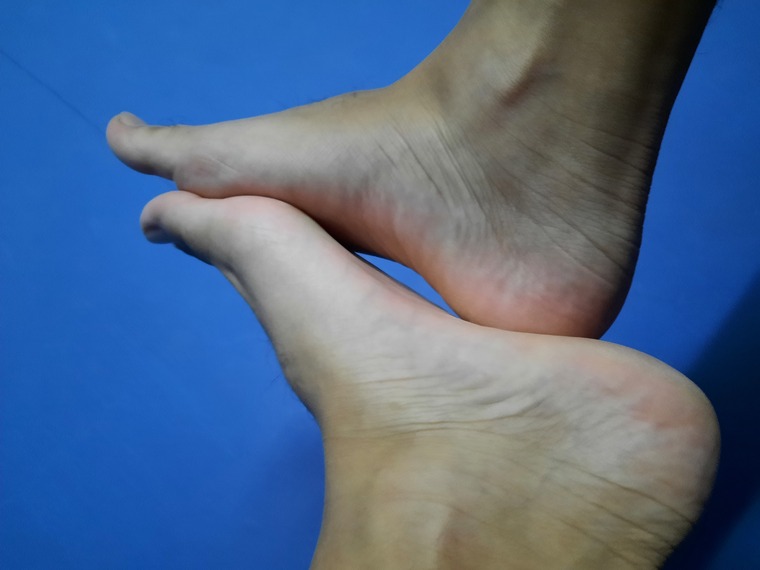 Doctor's feet banner image