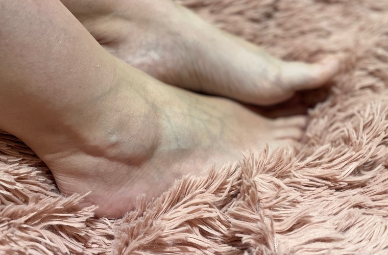 DoYouWantFeet banner image
