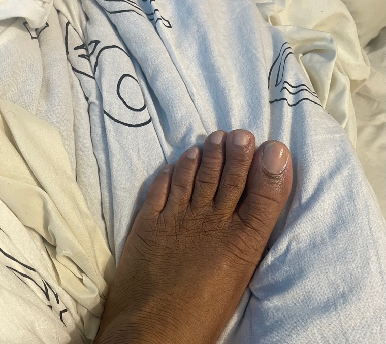 Butterscotch Toes cover image