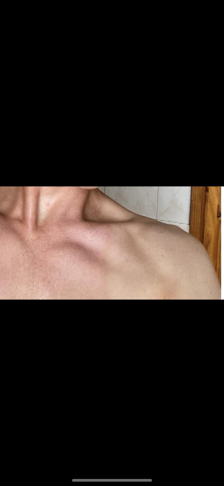 EoinF cover image