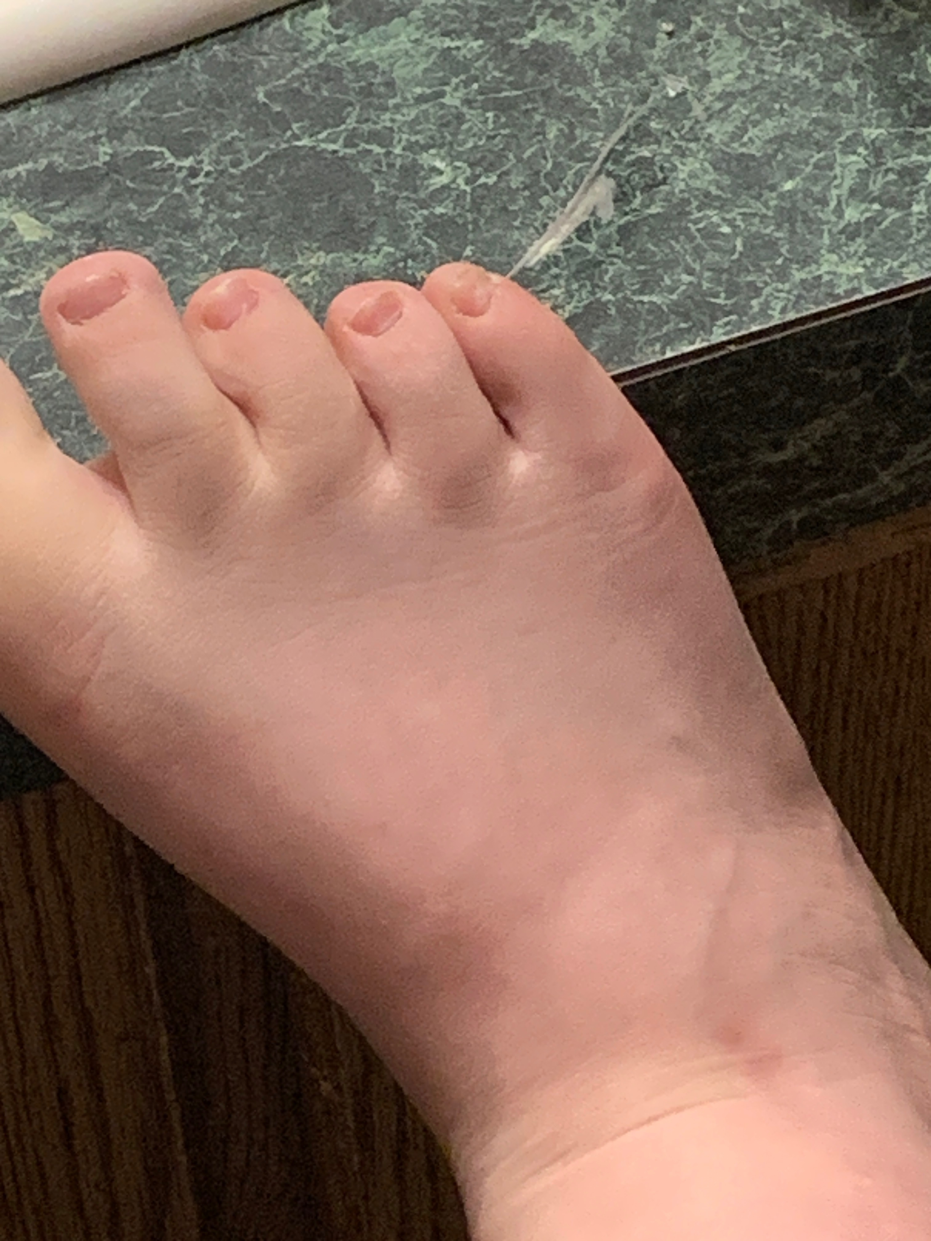 Little piggies 🦶 banner image