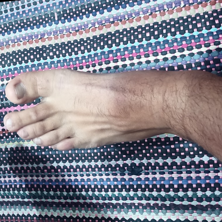 FeetMan cover image