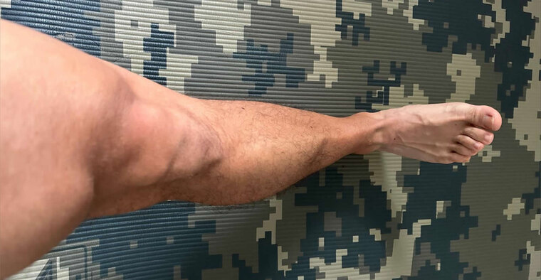 Post-Workout Toes banner image