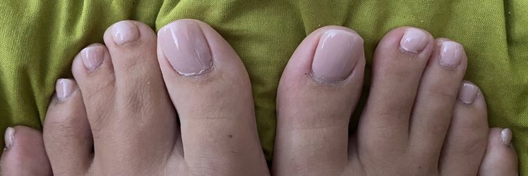 Feet Around The Corner banner image