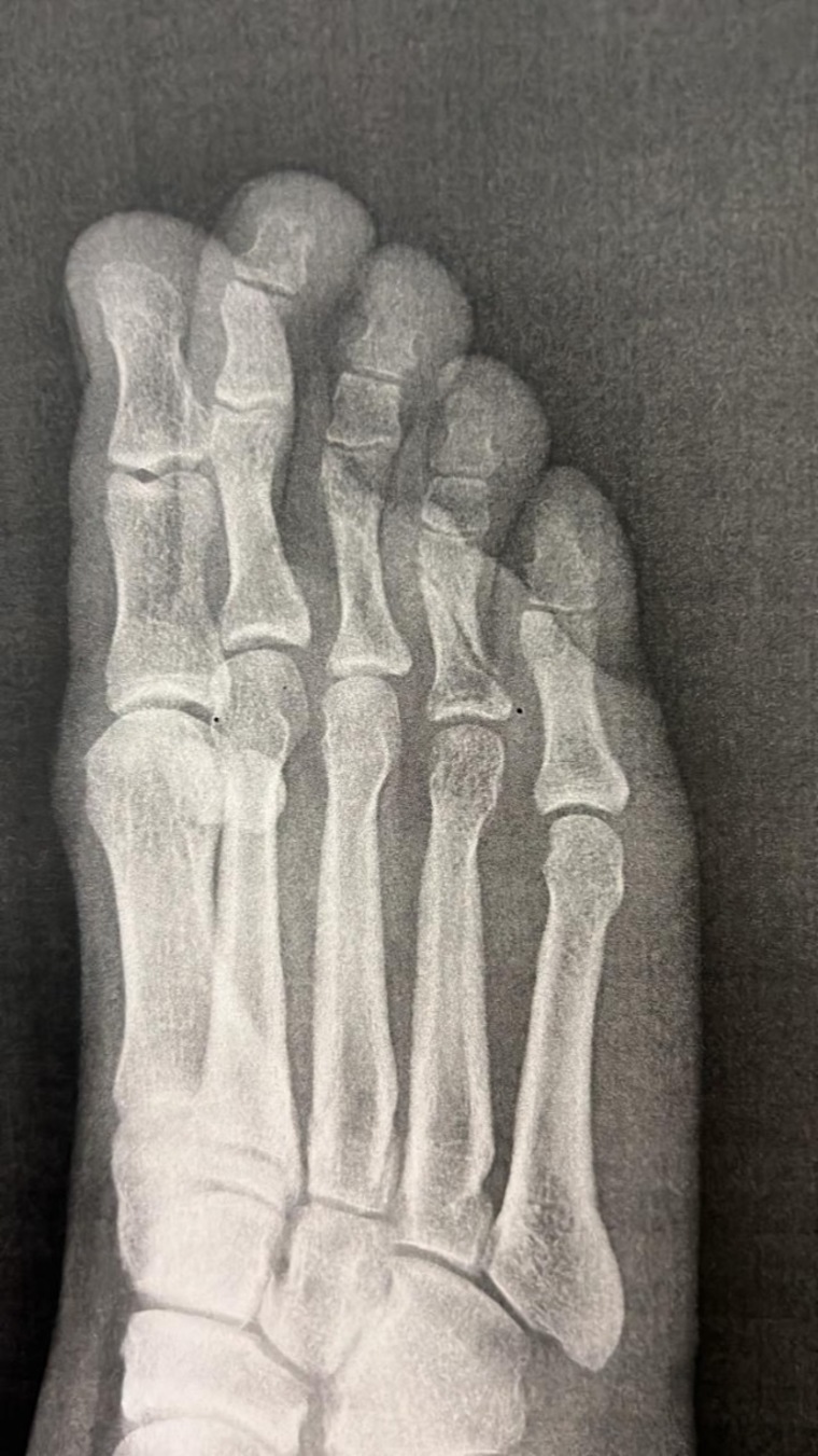 Feet for you ! banner image