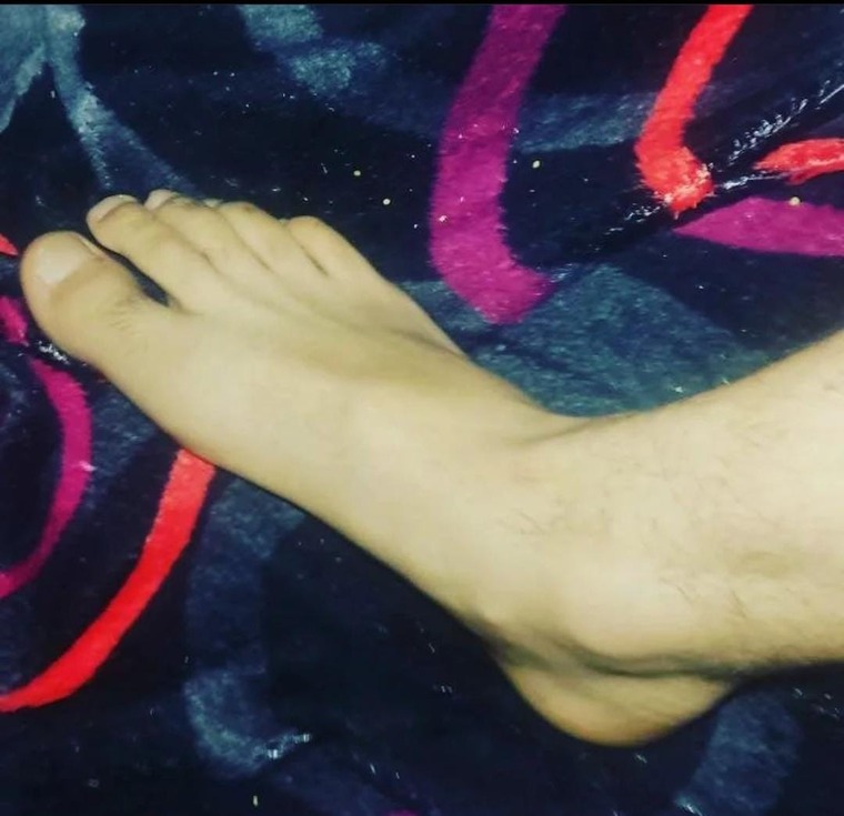 Feet cover image