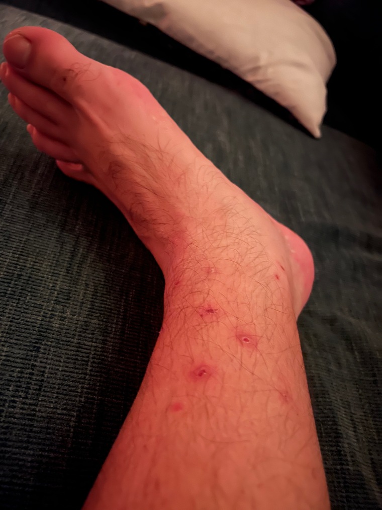 Feet stripper cover image