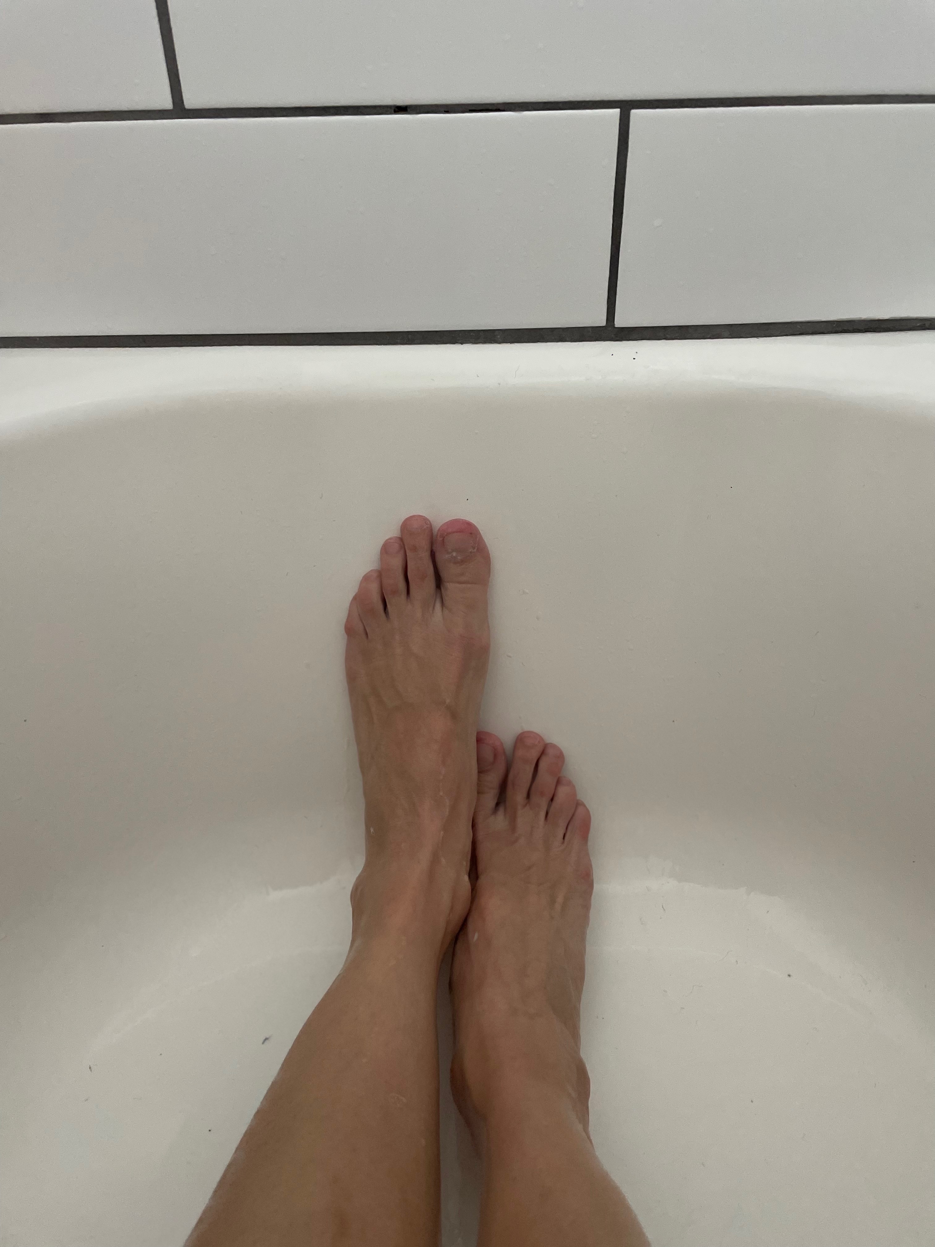 Fickle Feet ๐ banner image