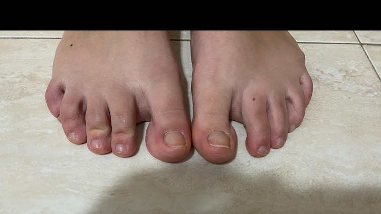 FingersFeets cover image
