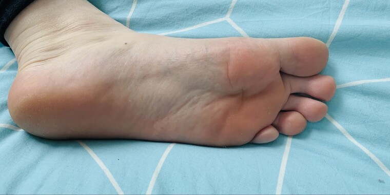 Les pieds de l’infirmière cover image