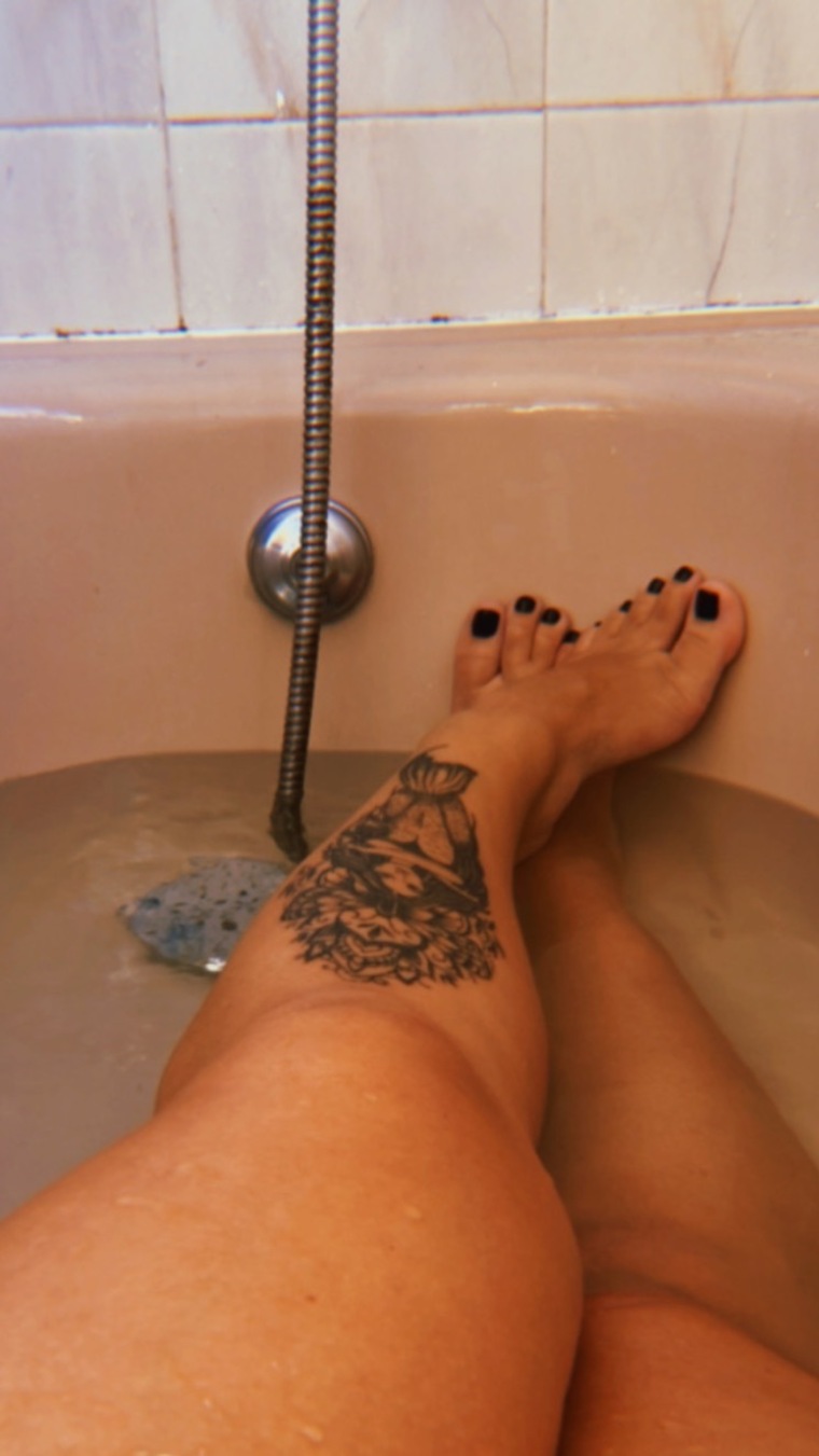 Redhead's foot โค๏ธโ๐ฅ๐ฆถ๐ป banner image
