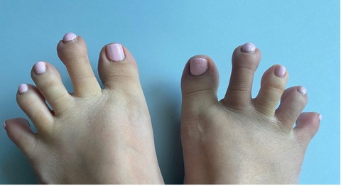 Fraulein Footfinger cover image