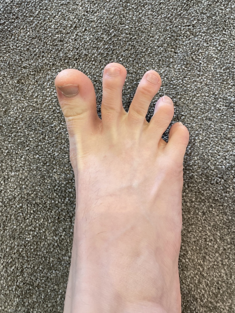 Freak Feet 69 banner image
