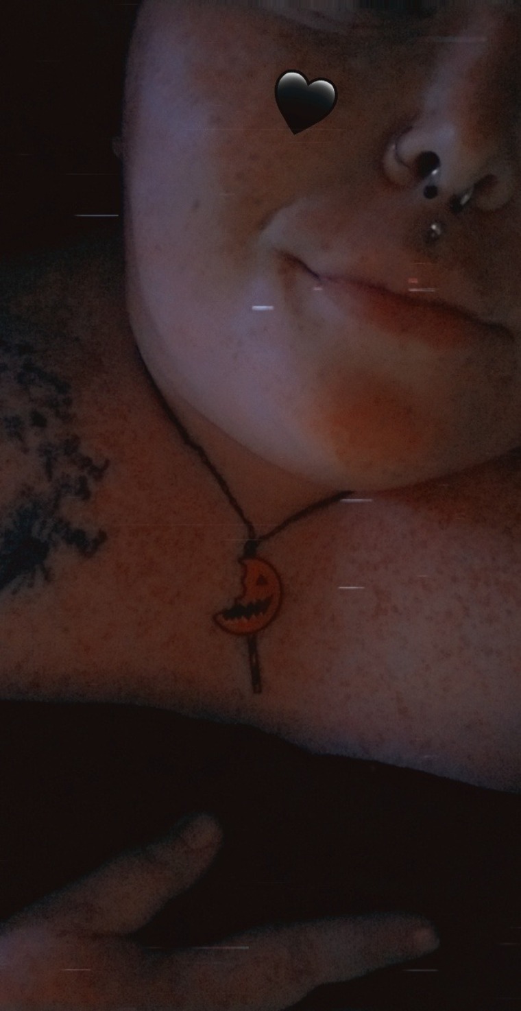 Freckle Face banner image