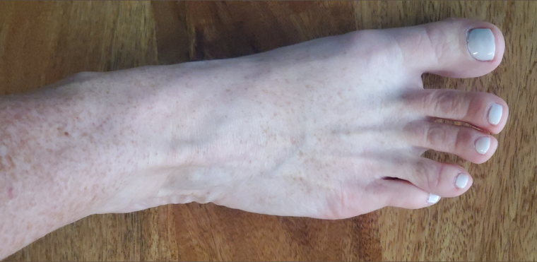 FrexyFeet banner image