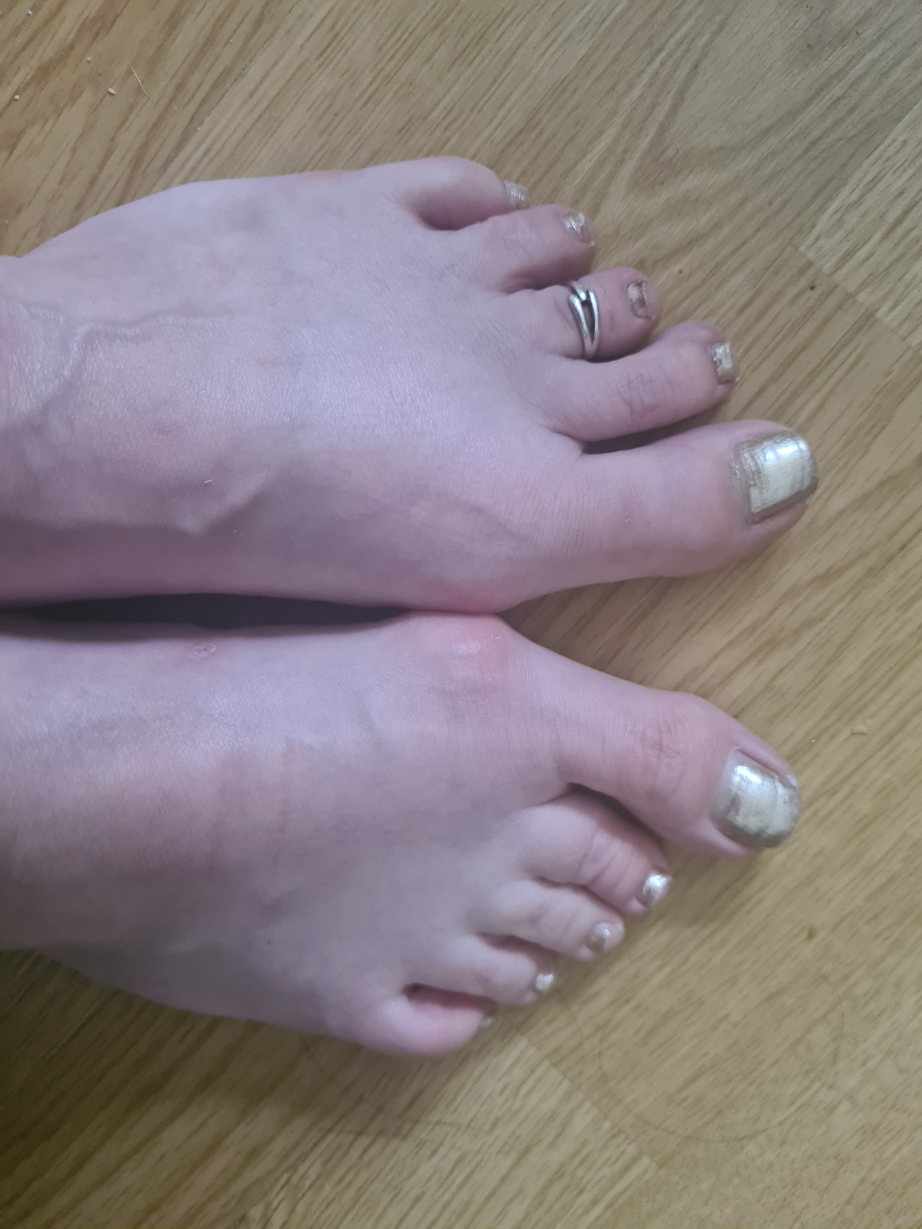 Grossfeet banner image