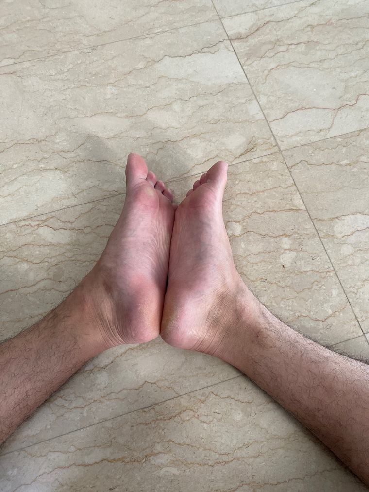 Hairy Asian Feet cover image