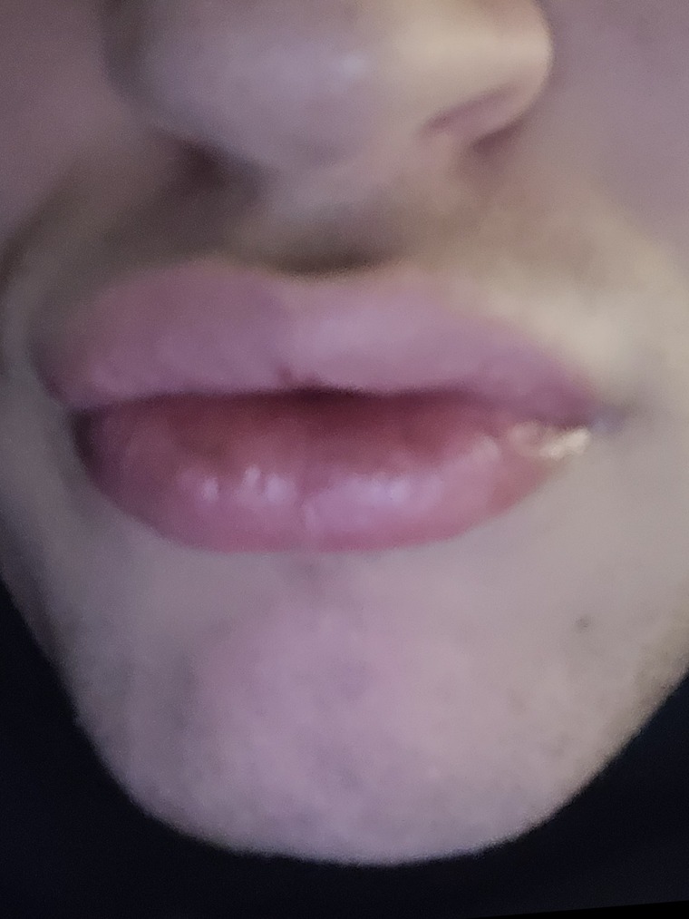 Hanibanislurp cover image