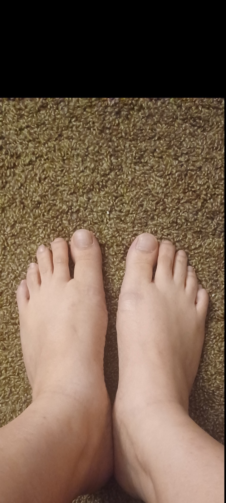 HelpMyToes banner image