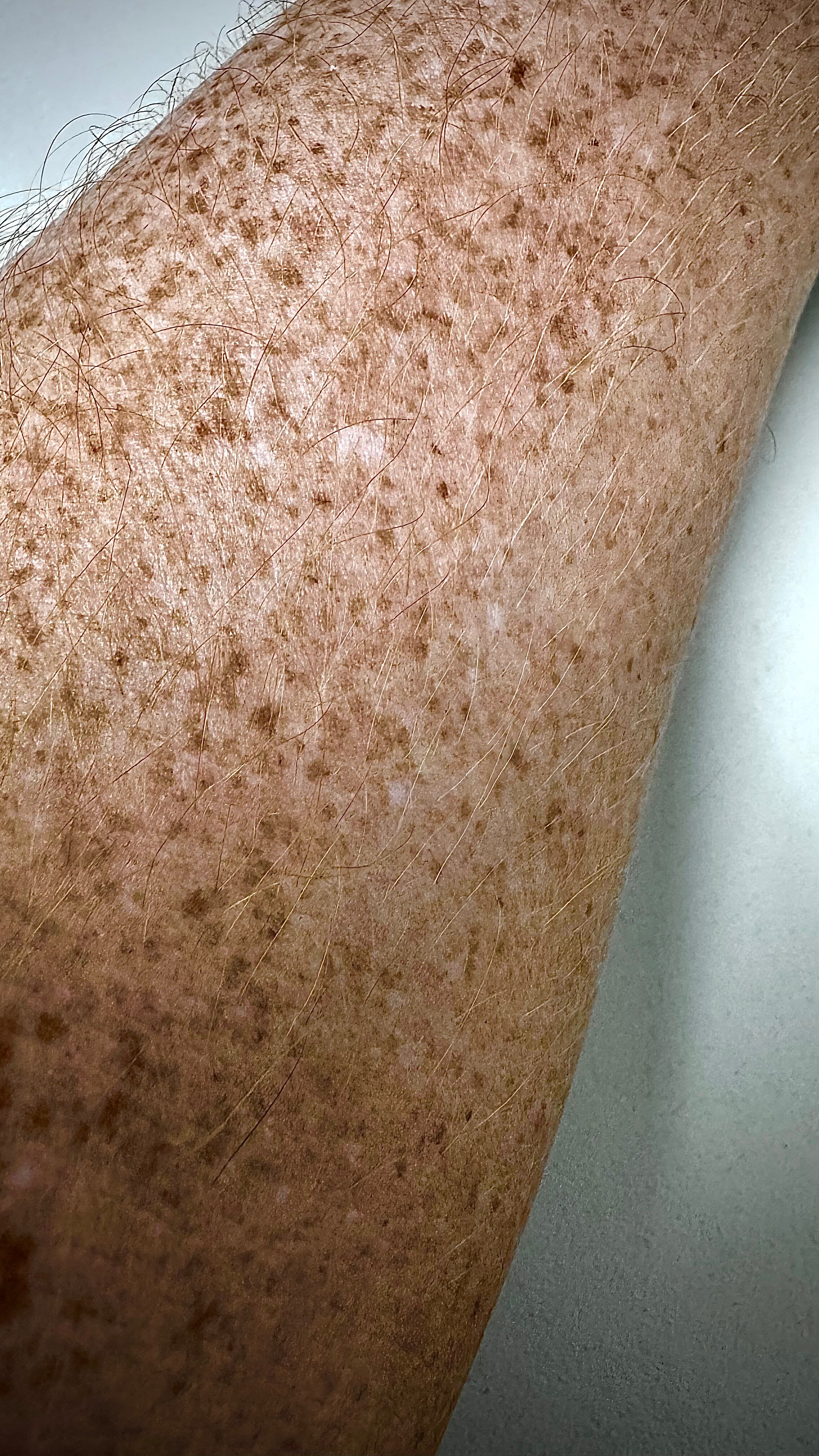 Hot Ginger ๐ฅ Ruivo Exclusivo banner image