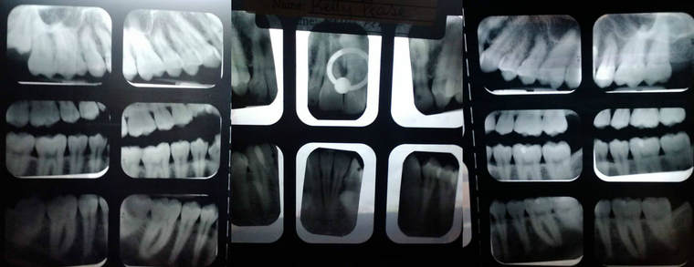 Human Lamprey cover image