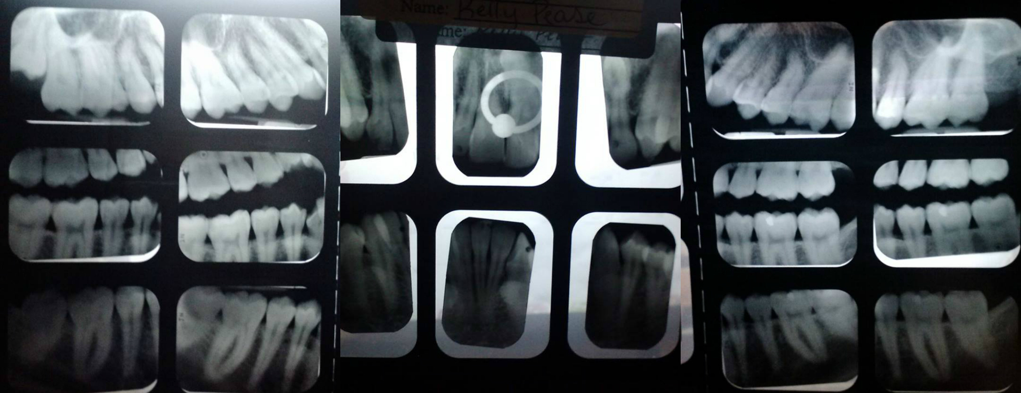 Human Lamprey banner image