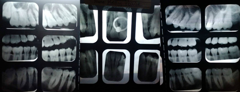 Human Lamprey cover image