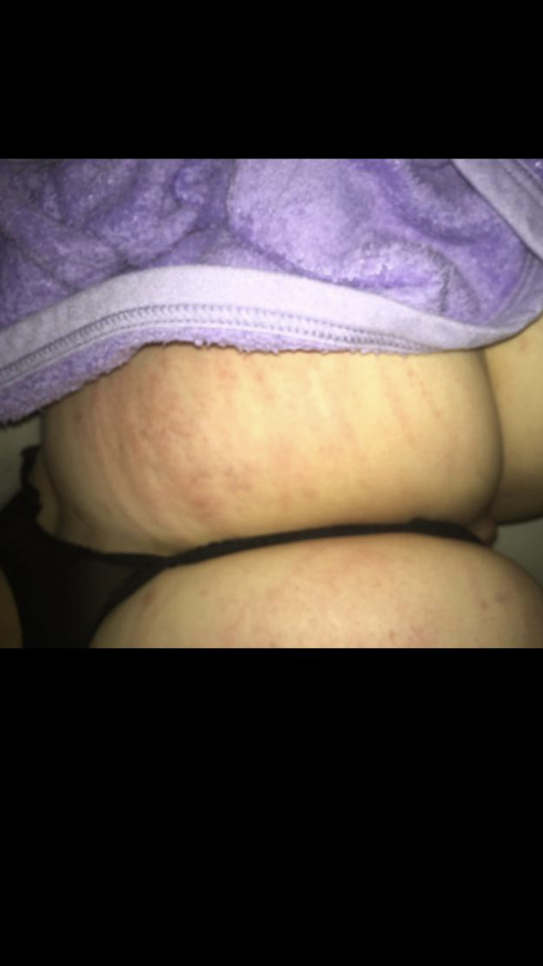 HotAa cover image