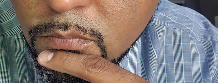 Eat-Man Slim :) banner image