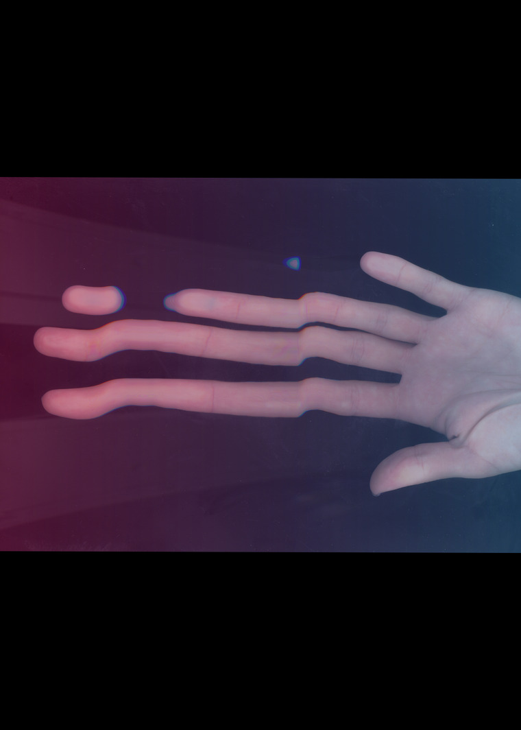 Iris banner image