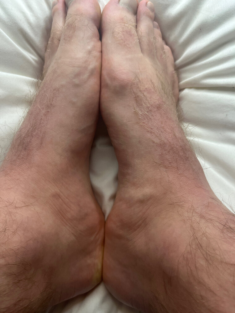 FeelFreshFeet FFF on OF banner image