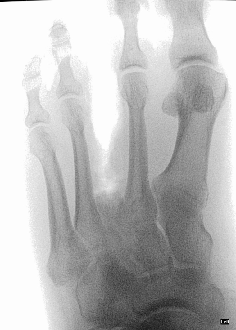 K-4toed_foot cover image