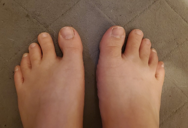 Kelly Toesies cover image