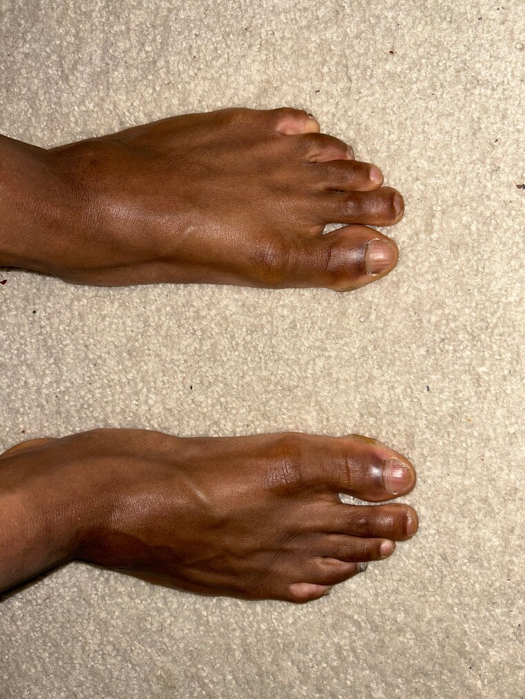 Princess feet cover image